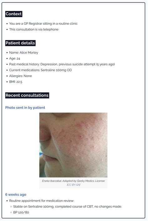 Image result for Using AI for SCA Revision