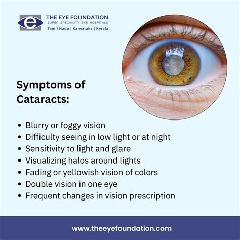 What are the symptoms of cataracts and how are they treated