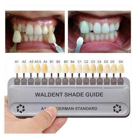 Waldent Clinical Shade Guide (German Standard) – Waldent.com