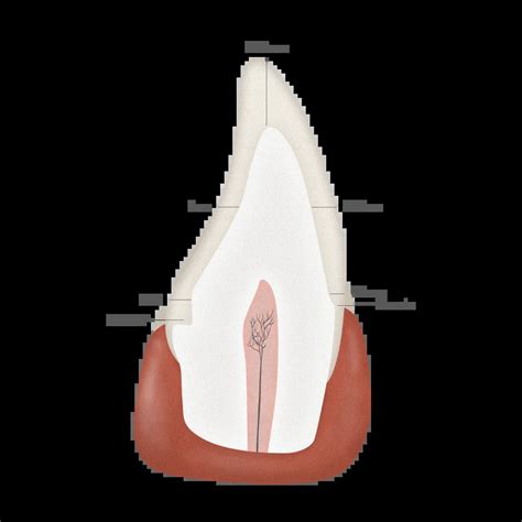 PFM Crown Prep Dimensions | Oceanic Dental