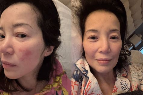 Kris Aquino thankful to 'hero' Bimb in new health update