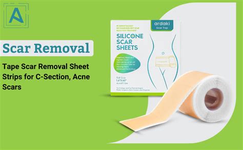 Buy ARDAKI Silicone Scar Sheets,Silicone Scar Tape,Scar Tape For ...