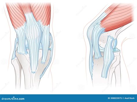 MLC Or Medial Collateral Ligament Anatomical Location In Knee Outline ...