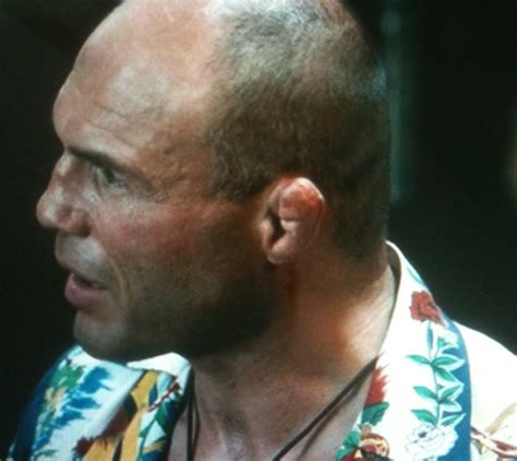 Kuvatulokset haulle cauliflower ear