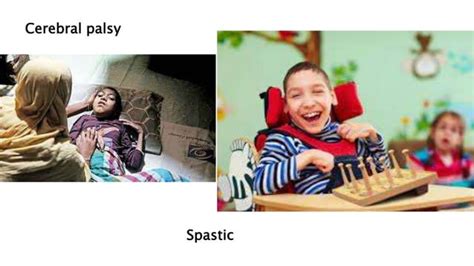 Image result for Types of Disabilities