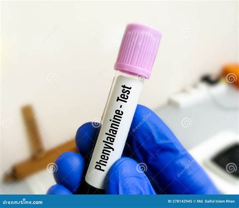 Blood Sample for Phenylketonuria (PKU) Test Stock Image - Image of ...