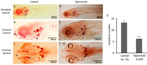Teratogenic Effects of Topiramate in a Zebrafish Model