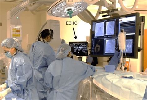 Image result for Manifold Cath Lab