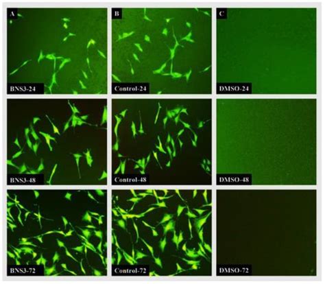 Synthesis of Silver-Coated Bioactive Nanocomposite Scaffolds Based on ...
