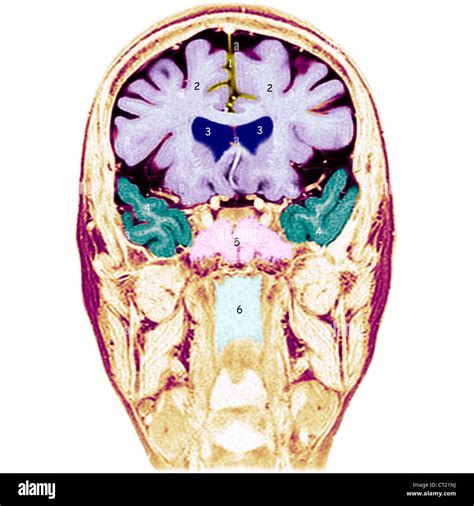 Medial longitudinal fissures hi-res stock photography and images - Alamy