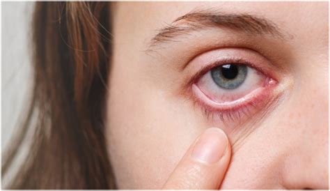 कोरोना के बाद कैसे करें आंखों का बचाव? स्वामी रामदेव से जानिए फंगल ...