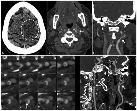 JCDD | Special Issue : Machine Learning and Artificial Intelligence in ...