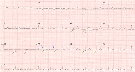Image result for Retraction Watch