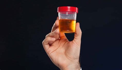 ¿Qué significa soñar que orinas sangre? Explora el significado de los sueños – onirosfera.com