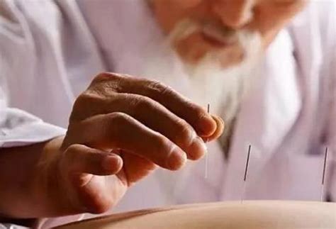 中国古代对针灸、经络、穴的原理是怎么解释的？ - 知乎
