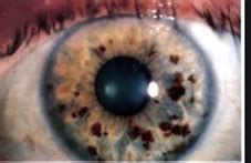 RRMs Next for PG Online Examination Platform