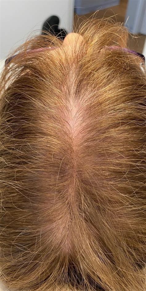 Image result for Reconstructing