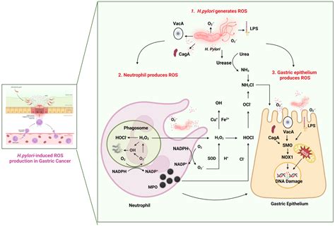 Reactive Oxygen Species and H. pylori Infection: A Comprehensive Review ...