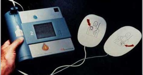 First Portable Defibrillator 的图像结果