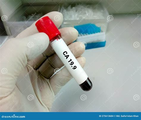 CA 19.9 Test, Tumor Marker for Pancreatic Cancer Stock Photo - Image of ...