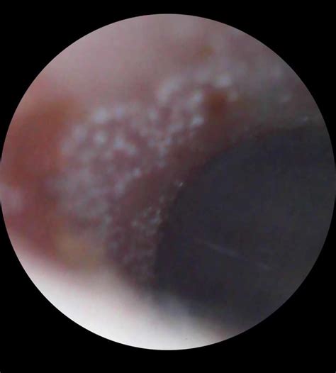 Found this while cleaning, my ears have been itchy but can’t find anything on Google. Any ideas ...