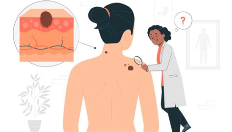 What is lipoma? Types, Risks, and Treatment | MediBuddy