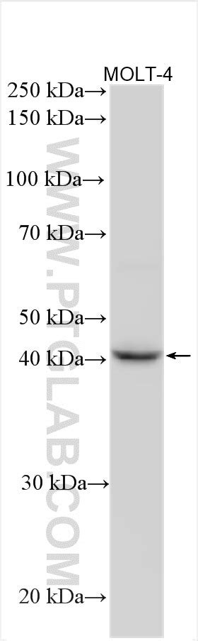 GNA15 antibody (12078-1-AP) | Proteintech