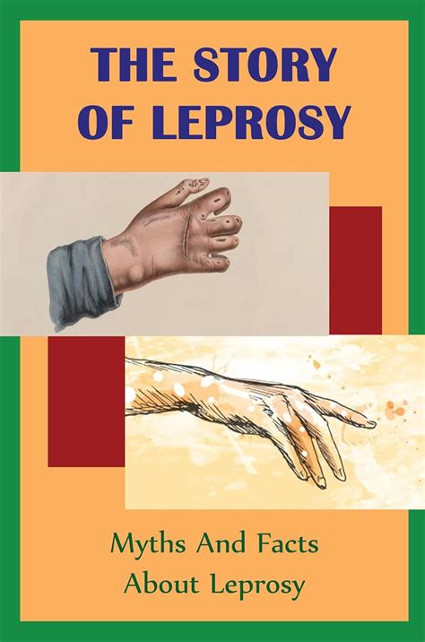 The Story Of Leprosy: Myths And Facts About Leprosy eBook : Fulwiler ...