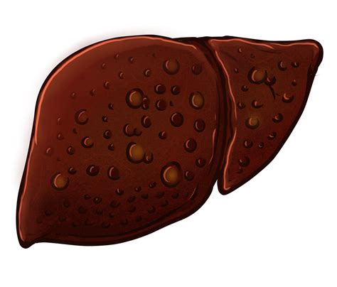 超过 2000 张关于“肝脏解剖”和“肝脏”的免费图片 - Pixabay