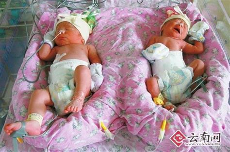 365天的魔怔后…证实我的双胞胎早产儿不是脑瘫 - 知乎