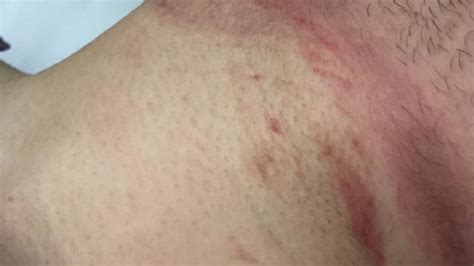 Image result for Famous Cases of Strangulation