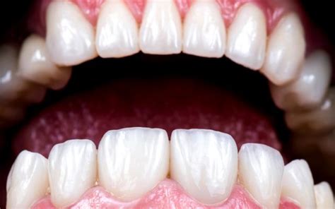 Image result for Grey Tooth