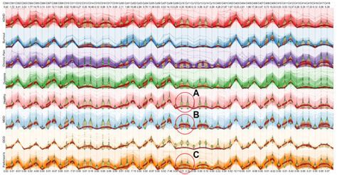 Identifying Patterns for Neurological Disabilities by Integrating ...