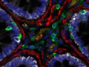 NCI-Funded Tool Combines Imaging Modalities to Aid Pathologists and ...