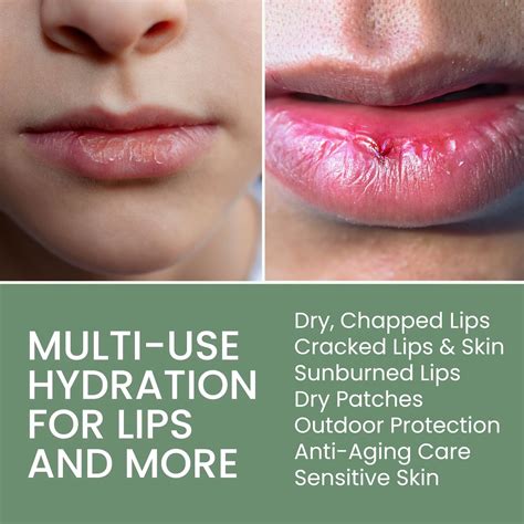 THENANaturalWellness Organic Lip Treatment Balm Ultra Hydrating & India ...