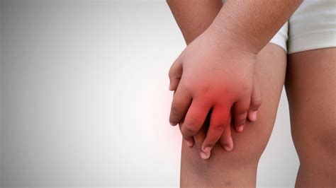 Juvenile Idiopathic Arthritis Treatment - Propel Physiotherapy