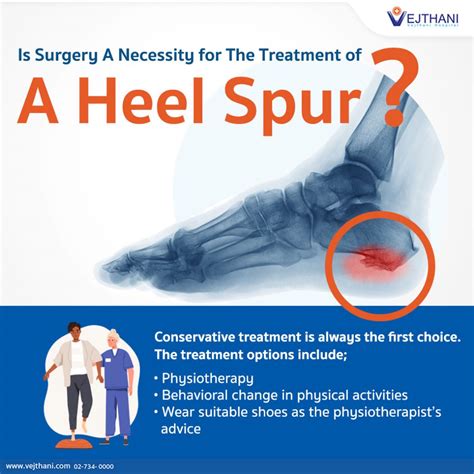 Heel Spur Exercises Rehab Heel Spur Treatment And Preventive Measures