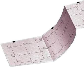 APEX INTERNATIONAL ECG Paper for MAC 500, 90 mm x 90 mm x 360S -5 ...