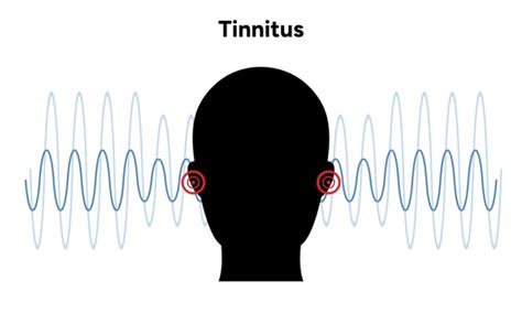 Image result for Stimulus Control Transfer ABA Example