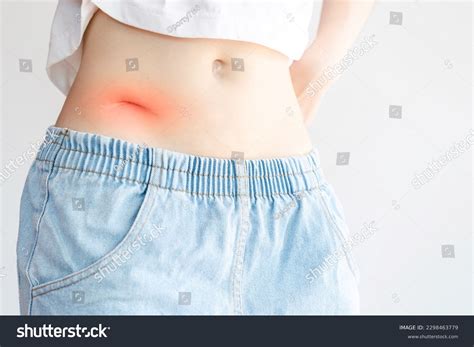 Image result for Appendix Surgery Scar