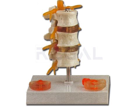 HERNIA PATHOLOGY – Regal Medical