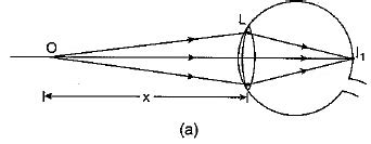 Class 10 Science Chapter 10 Previous Year Questions - The Human Eye and ...