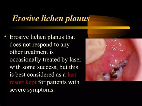 Laser in oral and maxilbfacial surgery | PPT