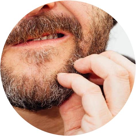 Sheopal's Beard Serum for Men | Best Beard Growth Serum in India – Sheopals