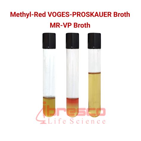 Test Del Rosso Di Metile Voges Proskauer