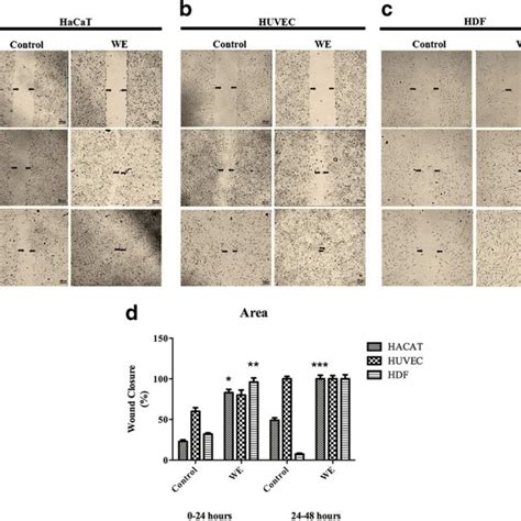 Image result for Scale Bar Magnification