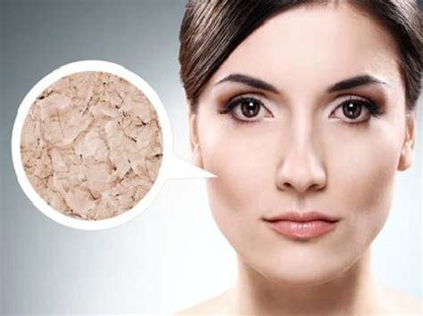Skin Pigmentation Is A Common Problem In Winter: Exclusive Beauty ...