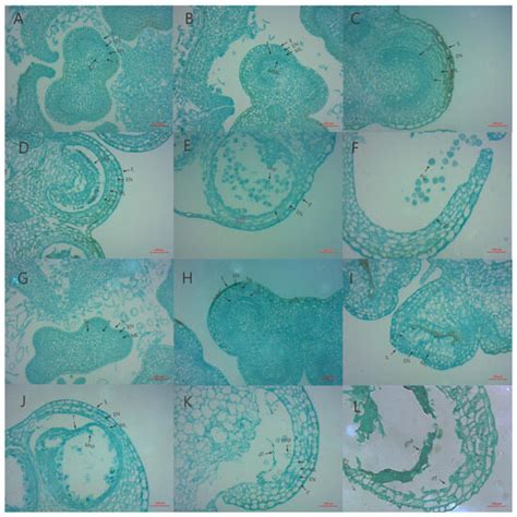Comparative Analysis of the Mitochondrial Genome of Eggplant (Solanum ...