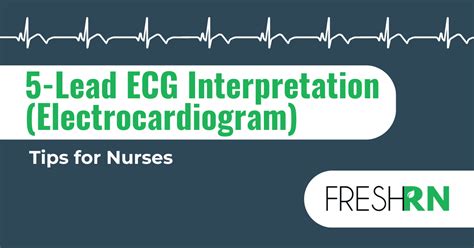 ECG Explained 的图像结果