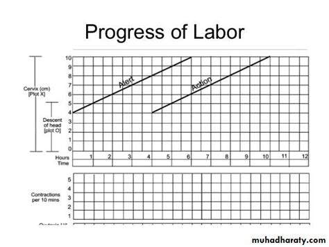Image result for Partogram Examples